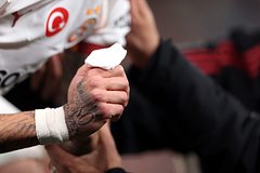 Чуть не потерявший палец во время матча игрок «Галатасарая» одной фразой оценил инцидент